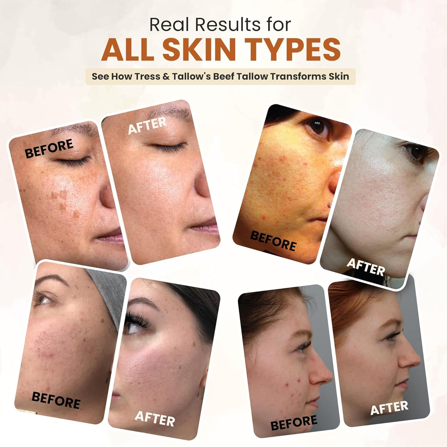 100% Organic Grass Fed Beef Tallow for Skin | Whipped Beef Tallow For Face | Tallow Moisturizer| Premium Beef Tallow for Women With Aloe Vera & Raw Honey & Beeswax- 5 FL.Oz