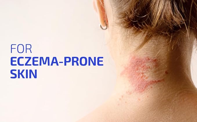 Codex Labs BIA Eczema Probiotic – 30 Capsules | Synbiotic for Eczema-Prone Skin with Clinically Proven Probiotics & Prebiotic Blueberry | Gut-Skin Barrier & Immune Support | 30-Day Supply