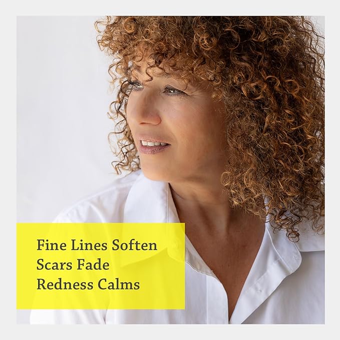 Silk Road Organic Helichrysum Italicum Essential Oil Spray, 100% Pure USDA Certified Aromatherapy for Skin Vitality & Anti-Aging – 1 Oz Spray - Always Pure, Always Organic